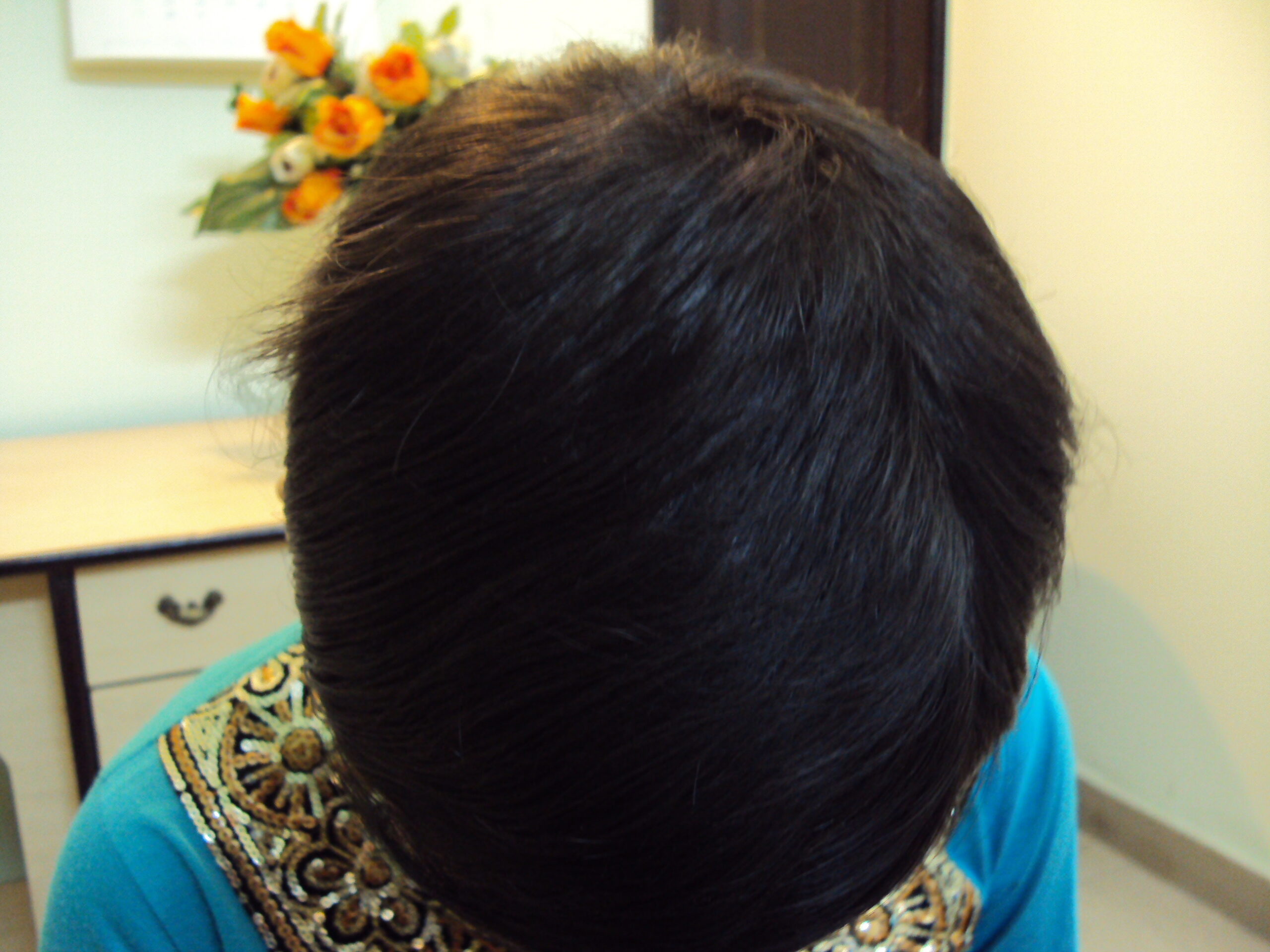 Taenia 4 D 530 KM.PAYAL SINGH 14 YRS.T.CAPITISCURED5 MAY 11 scaled