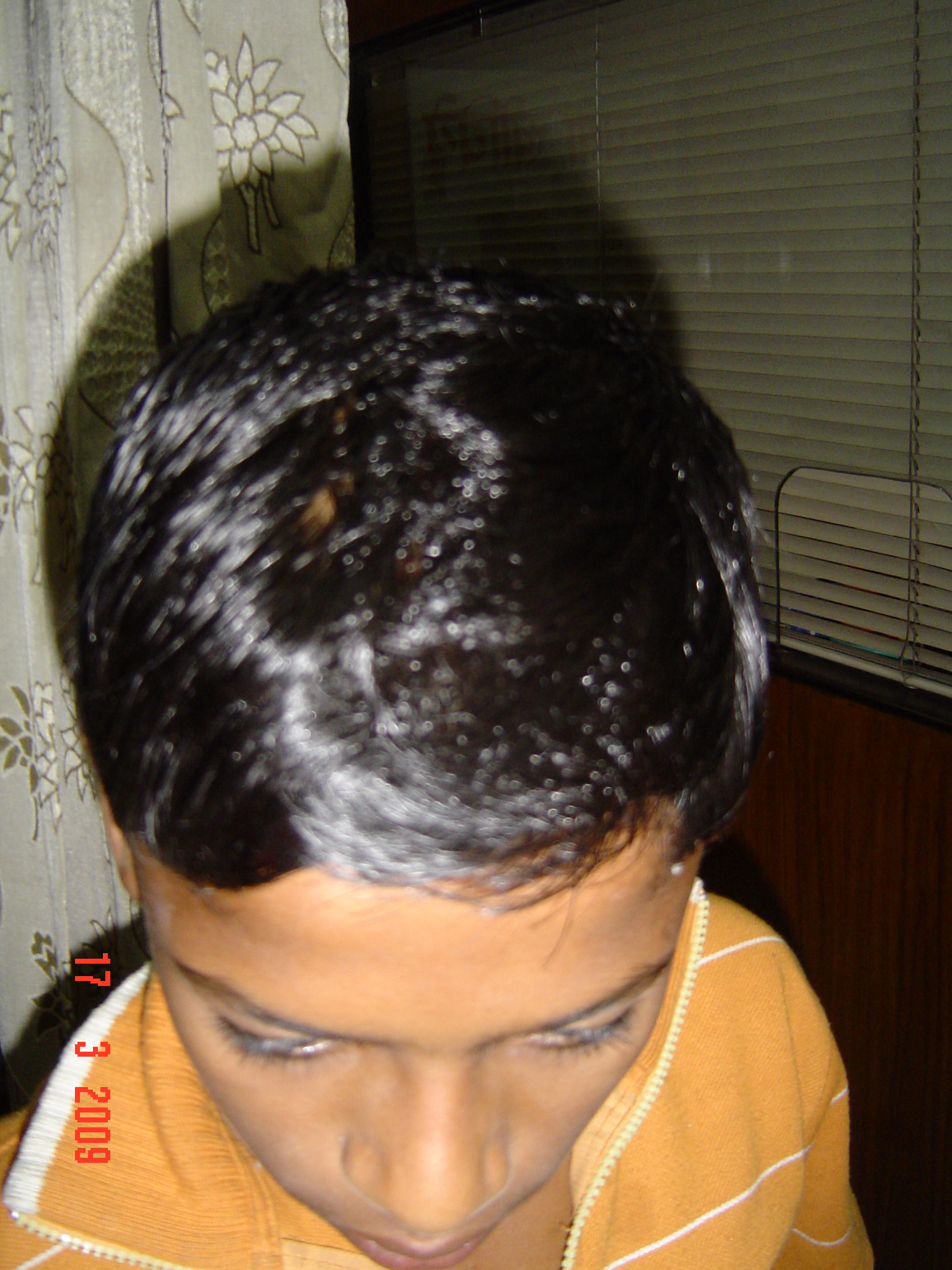 Taenia 6 E 244 MR.NITIN KUMAR 12 YRS.T.CAPITISCURED17 MAR 09