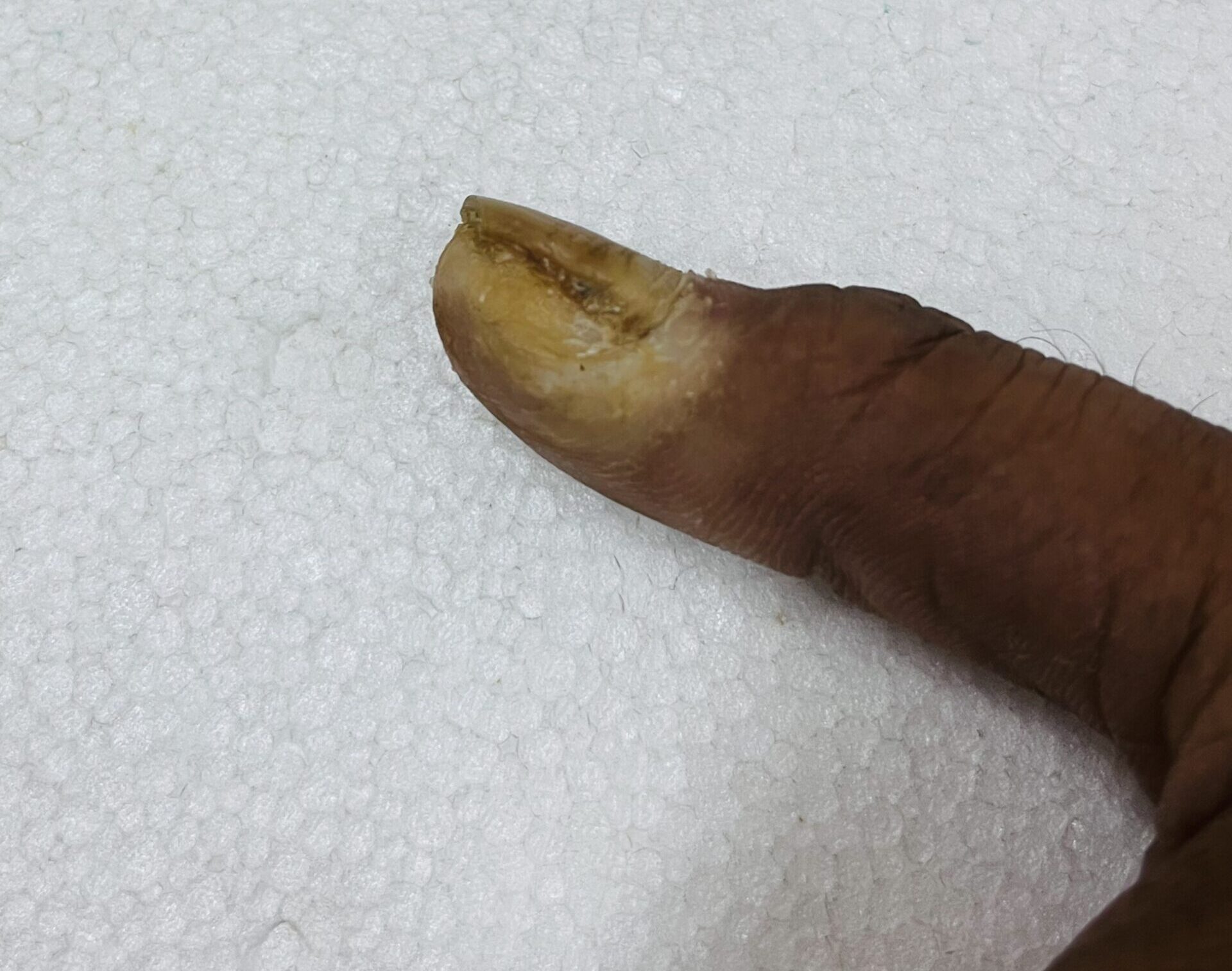 Warts 9 before scaled e1695668034424
