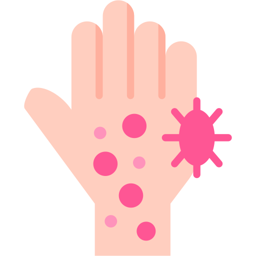 Urticaria