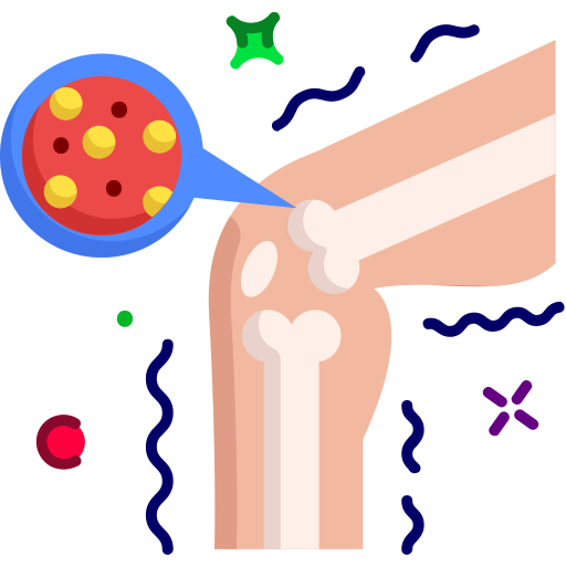 Osteoarthritis