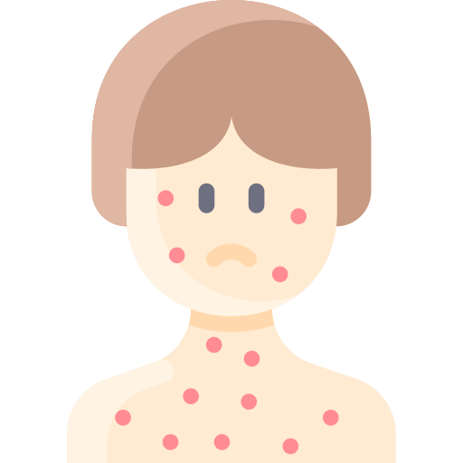 Impetigo