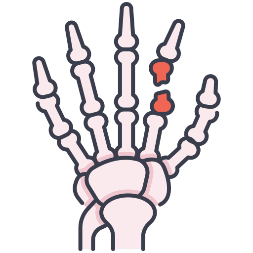 Ganglion