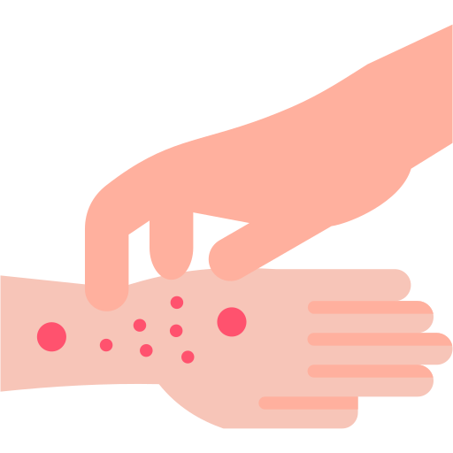 Tinea