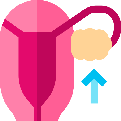 Ovarian cyst