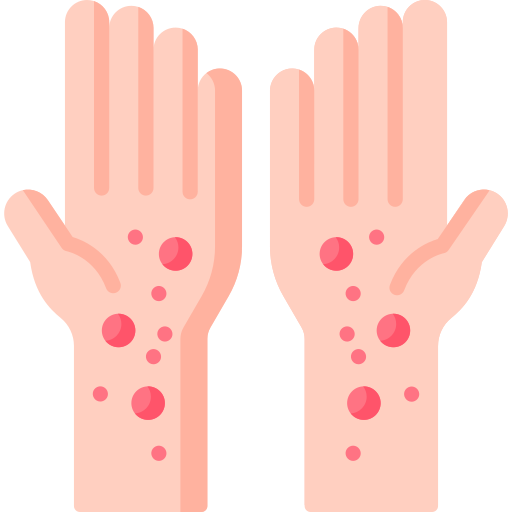 Psoriasis