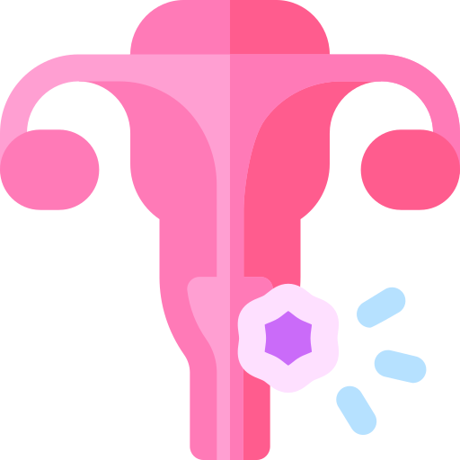 Uterine fibroids
